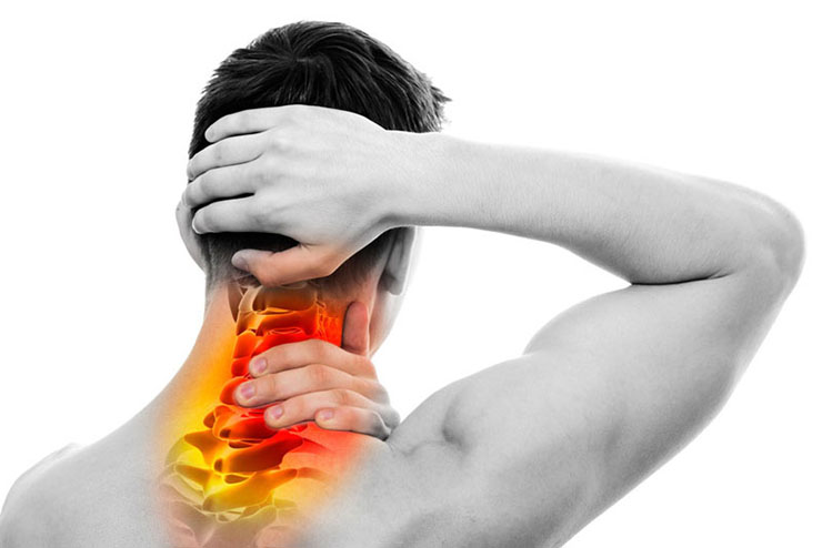 Thoái hóa đốt sống cổ sẽ làm viêm dây thần kinh gây đau đớn